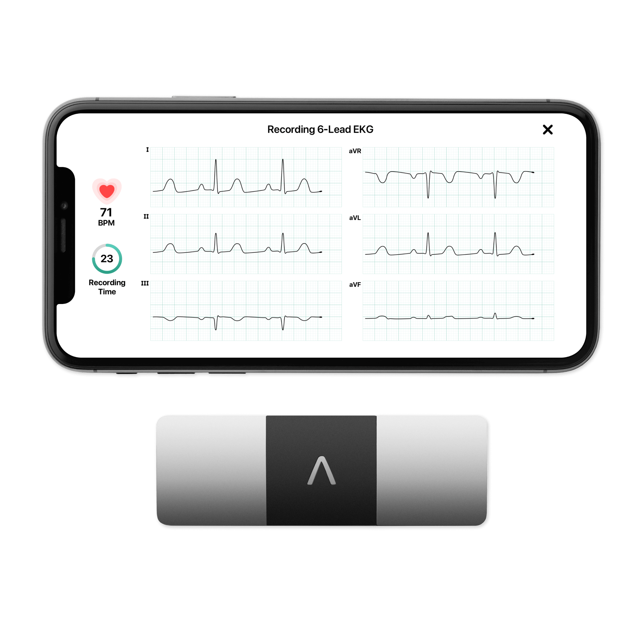 Applicable To Alivecor Kardiamobile 6l Intelligent Portable Ecg Detection  Health Equipment Heart Rate Monitor - Instrument Parts & Accessories -  AliExpress