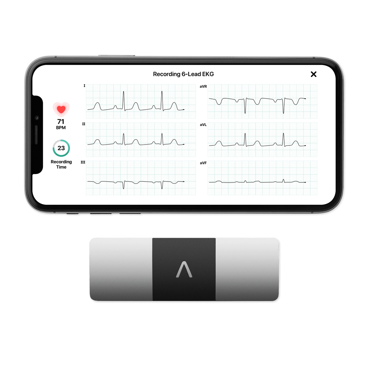 EKG Monitor with 6 Leads KardiaMobile 6L by AliveCor