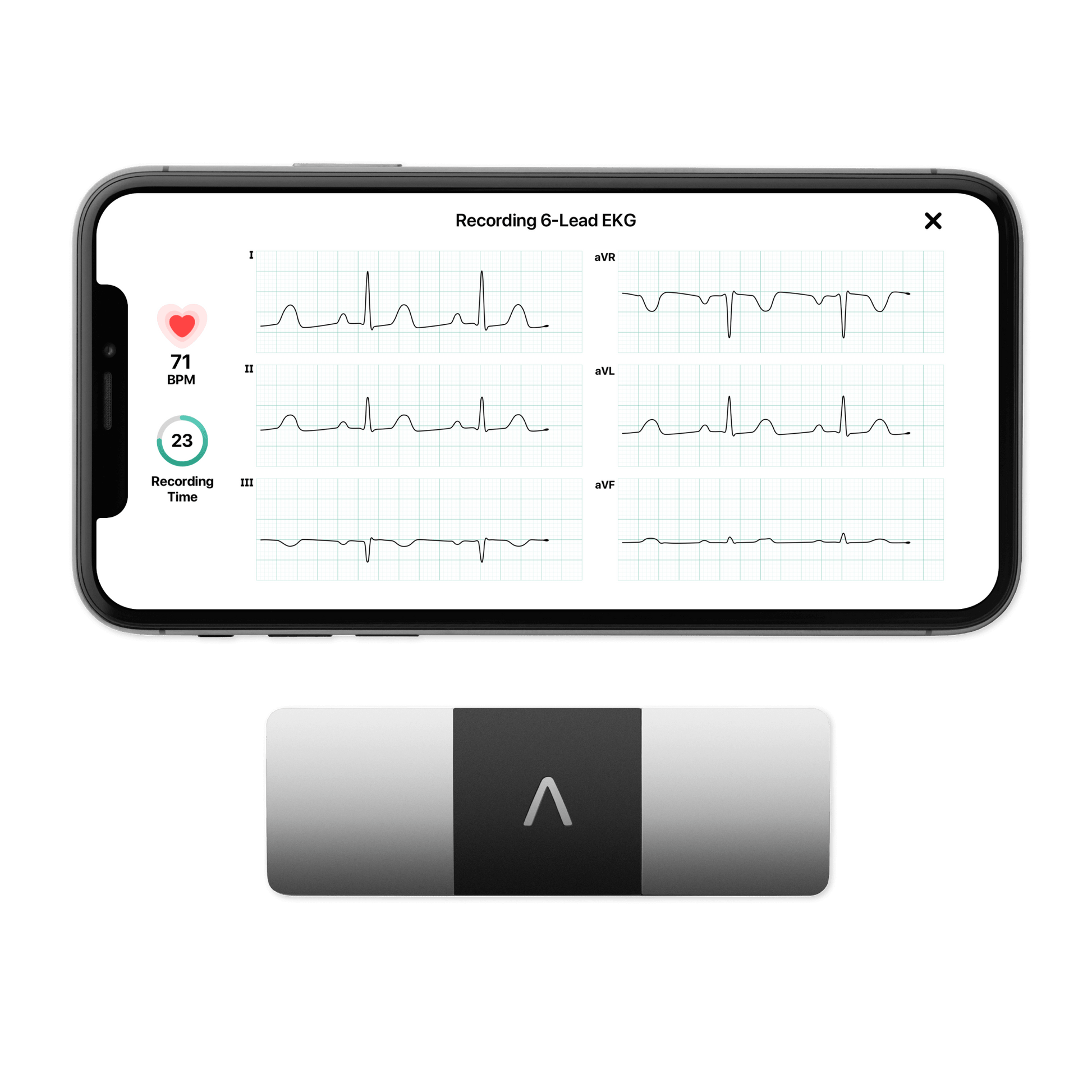KardiaMobile Card Personal EKG Monitor – Fits in Your Wallet – Detects AFib  and Irregular Arrhythmias – Instant Results in 30 Seconds – Easy to Use –