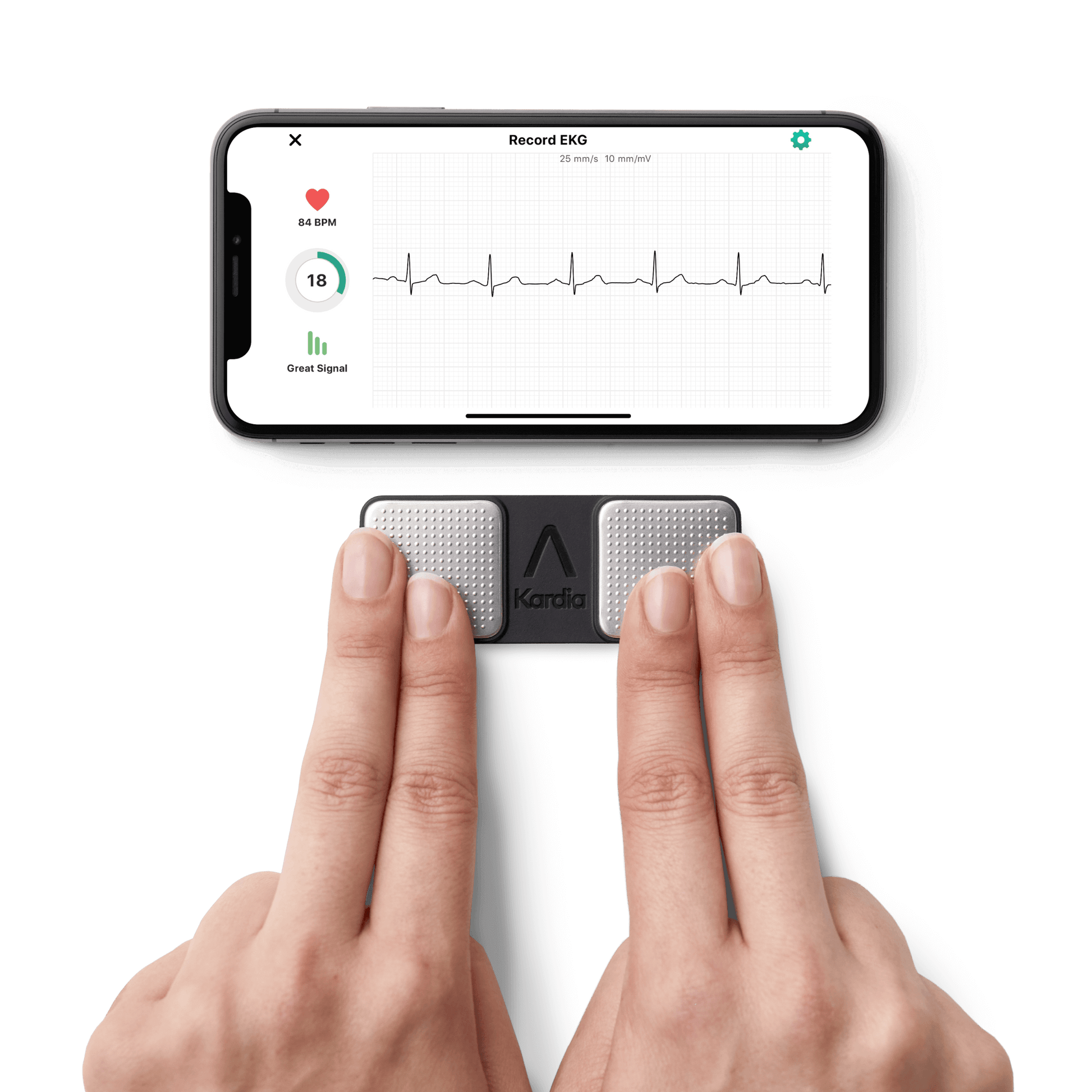 AliveCor KardiaMobile FDA Cleared 1-Lead Personal EKG Monitor
