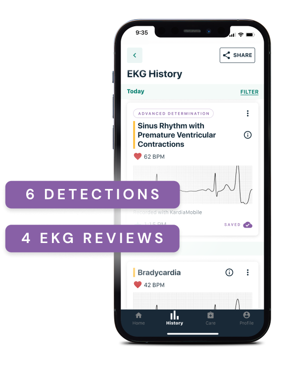 AliveCor Kardia Mobile EKG Monitor - Instant EKG on Your Phone