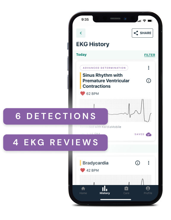 KardiaMobile EKG Monitor Instant EKG on Your Phone AliveCor